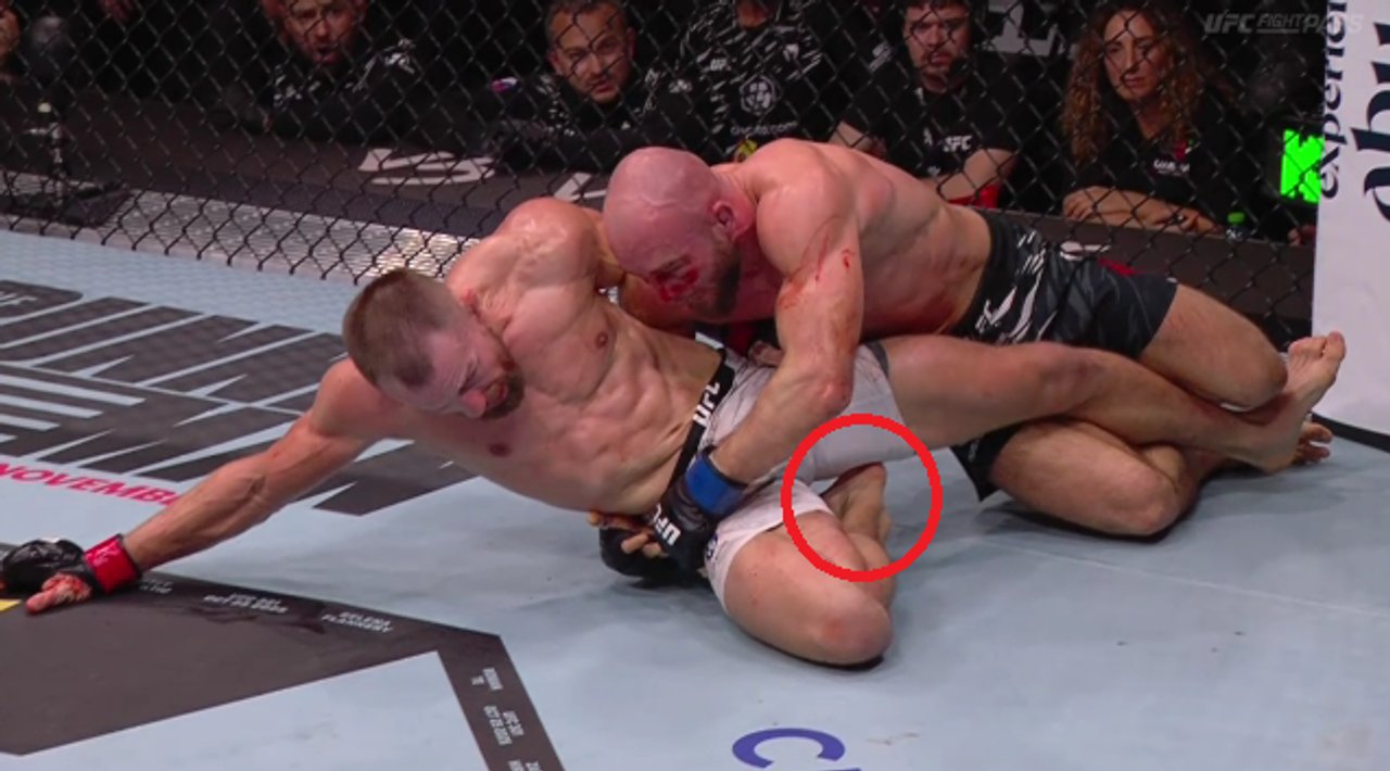 Dolor y gloria: Klein gana en UFC 321 con fractura de tobillo thumbnail