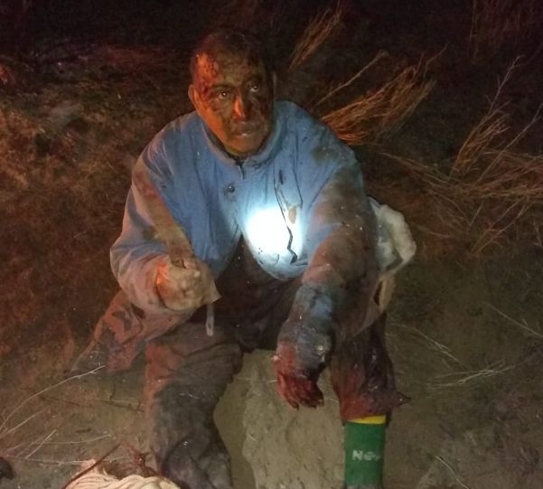 Río Negro: se trabó en lucha con un puma para salvar a su perro