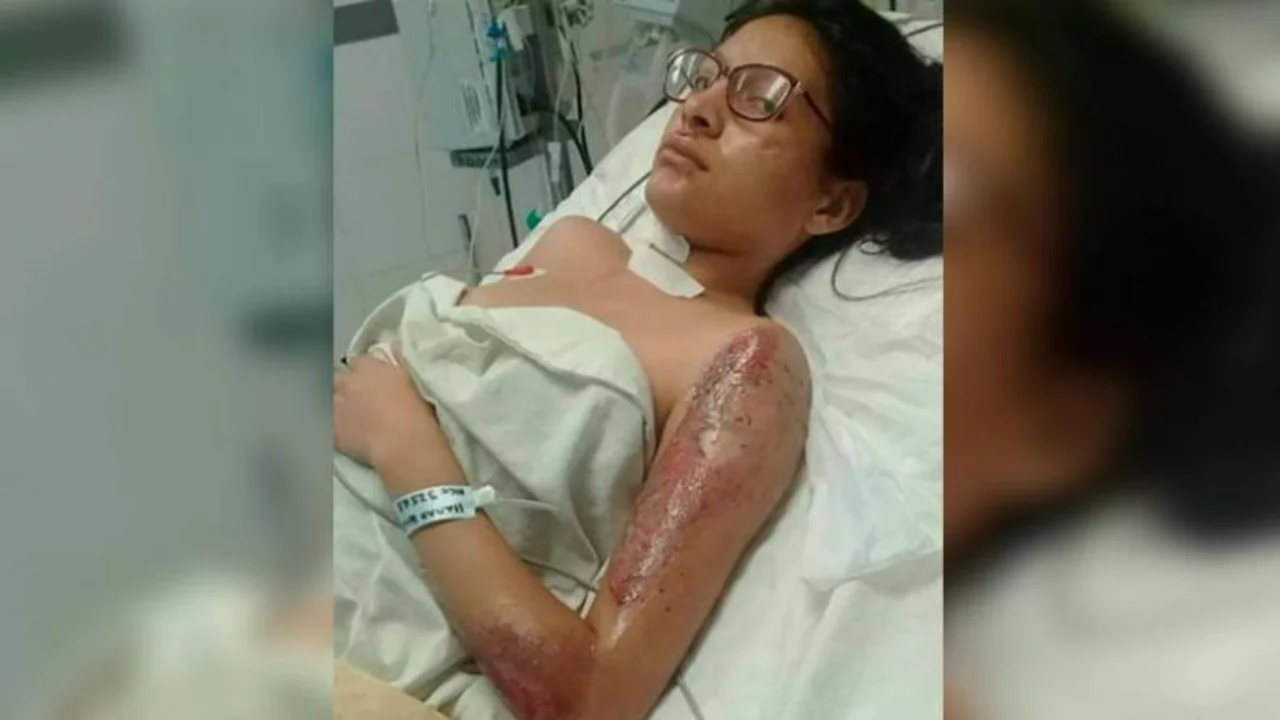 Un vehículo escapó tras atropellar a una joven