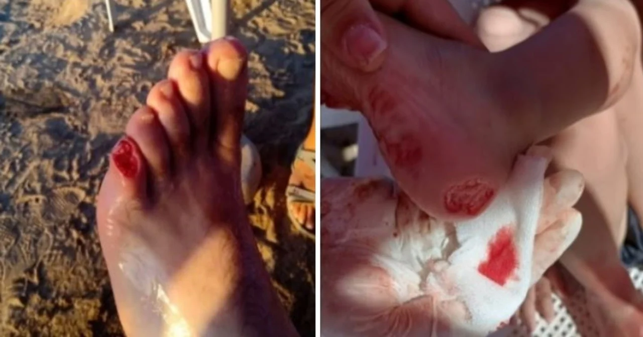 Las palometas representan un problema sin solución en el río Coronda.