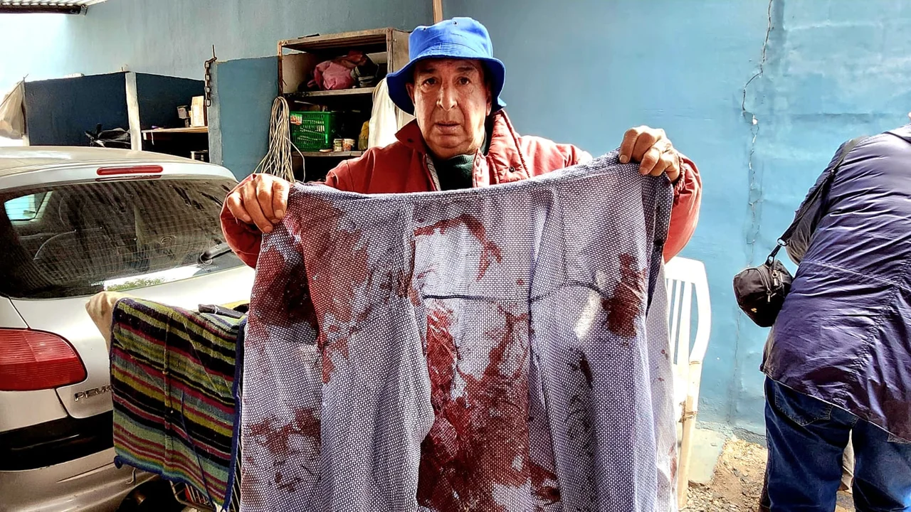 Vecino baleado. Foto: Roberto "Cany" Figueroa / Multimedio SRT