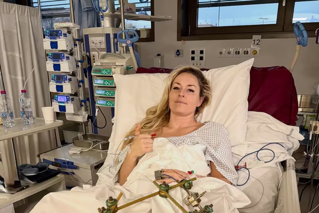 La leyenda Lindsey Vonn evoluciona favorablemente tras fractura de tibia en los Juegos de Invierno thumbnail